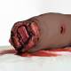 3B Scientific 1023314 Hemorrhage Control Leg Trainer - Dark Skin Tone, Wound Front View