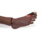 3B Scientific 1023316 Patient Care Manikin PRO Model P10/1D - Dark Skin Tone - Diabetic foot syndrome (DFS)