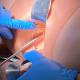 3B Scientific 1023727 Postpartum Hemorrhage Trainer PRO, Suturing Repair (Gloves and Suturing Tools not included)