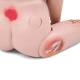 3B Scientific 1025295 Light Skin Tone Patient Care Manikin PRO Model P10N - Bedsores (Decubitus) - Grade 2 and Grade 4