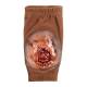 STOPS Medical 1025870 Brachial Wound Sleeve - Dark Skin Tone