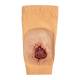 STOPS Medical 1025875 Brachial Wound Sleeve - Light Skin Tone