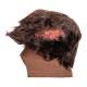 STOPS Medical 1025981 Lacerated Scalp Hood with Hair - Dark Skin Tone