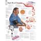 High Blood Pressure Chart