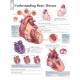 Understanding Heart Disease Chart