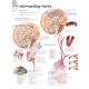 Understanding Stroke Chart