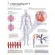 Understanding DVT (Deep Vein Thrombosis) Chart