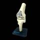 Bone Models™ 390301 Bone Shade Knee Model with Generic Implant, Front View