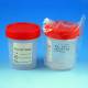 Sterile 4oz Specimen Container with 1/4-Turn Red Screw Cap and Tri-Lingual ID Label