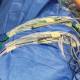 Domico Med-Device 6000 Cord Management Drape™ - in Operating Room Setting (Items in the photo are not included)