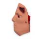 Life/form Moulage Wound - Anthrax, Forehead Simulator
