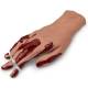 Life/form Moulage Wound - Hand with Severed Fingers Simulator