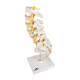 3B Scientific 8000874 Anesthesiology Lab Set, Lumbar Vertebral Column Model