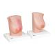 3B Scientific 8000875 Breast Examination Set, Female Breast with Healthy and Unhealthy Tissue Model