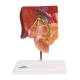 3B Scientific 8000884 Gallbladder Set, Gallstone Model