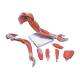3B Scientific 8000886 Upper Intramuscular Injection Training Set, Deluxe Muscle Arm Model