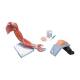 3B Scientific 8000886 Upper Intramuscular Injection Training Set