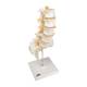 3B Scientific 8000890 Lumbar Spinal Injection Kit, Lumbar Vertebral Column Model
