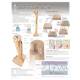 Bone & Bone Growth Laminated