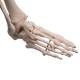 3B Scientific A10-1 Stan the Standard Skeleton on Hanging Roller Stand - 3B Smart Anatomy