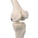 3B Scientific A18-5 Mini Skeleton with Painted Muscles on Pelvic Mounted Base