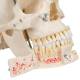 3B Scientific A27 Deluxe Human Demonstration Skull (10-Part) - 3B Smart Anatomy
