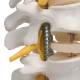 3B Scientific A59-1 Highly Flexible Spine Model - 3B Smart Anatomy