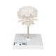 3B Scientific A75-1 Atlas and Axis with Occipital Plate on Stand - 3B Smart Anatomy
