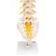 3B Scientific A76/5 Human Lumbar Spinal Column Model with Dorso-Lateral Prolapsed Intervertebral Disc - 3B Smart Anatomy