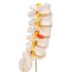 3B Smart Anatomy Human Lumbar Spinal Column Model with Dorso-Lateral Prolapsed Intervertebral Disc Model A76-5