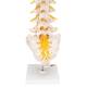 3B Smart Anatomy Human Lumbar Spinal Column Model with Dorso-Lateral Prolapsed Intervertebral Disc Model A76-5