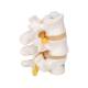 3B Scientific A76/8 Three Lumbar Vertebrae Flexibly Mounted - 3B Smart Anatomy