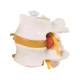 3B Scientific A76-9 Two Lumbar Vertebrae with Prolapsed Disc Flexibly Mounted - 3B Smart Anatomy