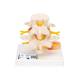 3B Scientific A76 Lumbar Vertebrae Teaching Model - 3B Smart Anatomy
