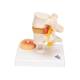 3B Scientific A76 Lumbar Vertebrae Teaching Model - 3B Smart Anatomy
