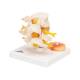 3B Scientific A76 Lumbar Vertebrae Teaching Model - 3B Smart Anatomy