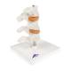 3B Scientific A78 Deluxe Osteoporosis Model (3 Vertebrae) - 3B Smart Anatomy