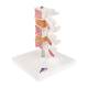 3B Scientific A78 Deluxe Osteoporosis Model (3 Vertebrae) - 3B Smart Anatomy