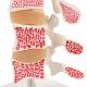 3B Scientific A78 Deluxe Osteoporosis Model (3 Vertebrae) - 3B Smart Anatomy
