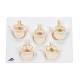 3B Scientific A792 Set of 5 BONElike Lumbar Vertebrae - 3B Smart Anatomy