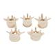 3B Scientific A792 Set of 5 BONElike Lumbar Vertebrae - 3B Smart Anatomy