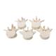 3B Scientific A792 Set of 5 BONElike Lumbar Vertebrae - 3B Smart Anatomy