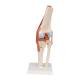3B Scientific A82-1 Deluxe Functional Knee Joint Model - 3B Smart Anatomy