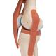 3B Scientific A82-1 Deluxe Functional Knee Joint Model - 3B Smart Anatomy