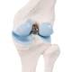 3B Scientific A85-1 Mini Knee Joint with Cross Section of Bone - On Base - 3B Smart Anatomy