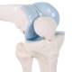 3B Scientific A85-1 Mini Knee Joint with Cross Section of Bone - On Base - 3B Smart Anatomy