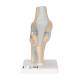3B Scientific A89 Sectional Knee Joint Model 3-Part - 3B Smart Anatomy