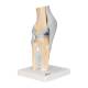 3B Scientific A89 Sectional Knee Joint Model 3-Part - 3B Smart Anatomy