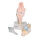 3B Scientific A89 Sectional Knee Joint Model 3-Part - 3B Smart Anatomy