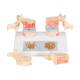 3B Scientific A95 Osteoporosis Model - 3B Smart Anatomy